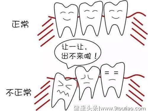 你真的对自己的牙齿了解过吗？