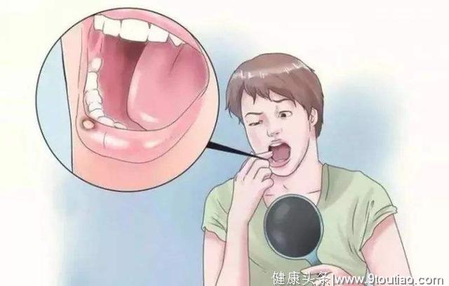 口腔溃疡反复发作，究竟是哪些原因造成的？你了解过吗