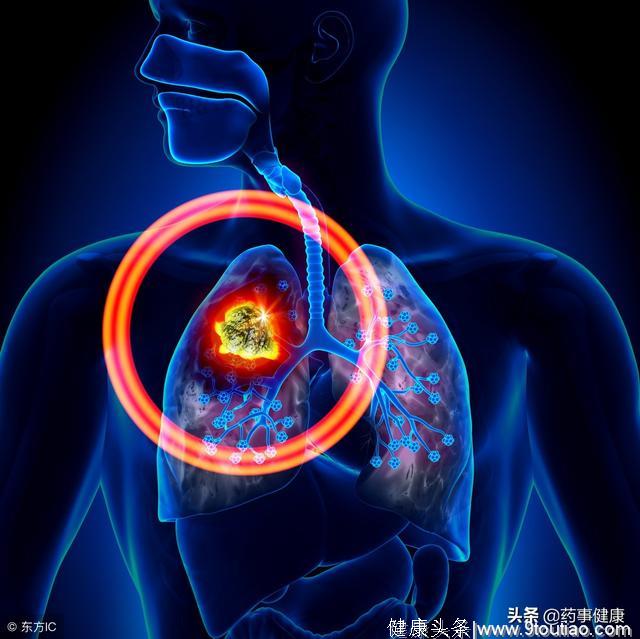 非小细胞肺癌约占肺癌的80%～90%，用靶向药物可以有效的治疗吗
