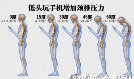 落枕、颈椎病  傻傻分不清？！