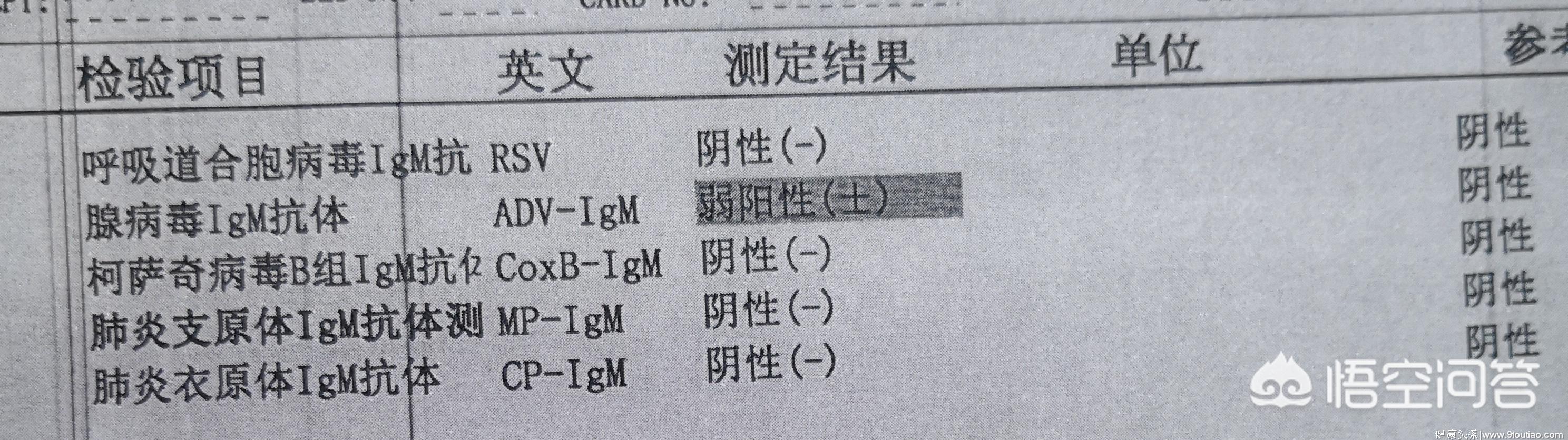 如何辨别病毒性感冒还是细菌性感冒？