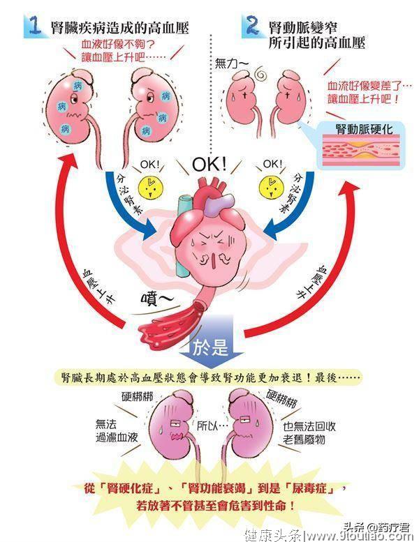 别小看高血压，轻忽恐造成肾功能衰退，形成肾衰竭，直至尿毒症！