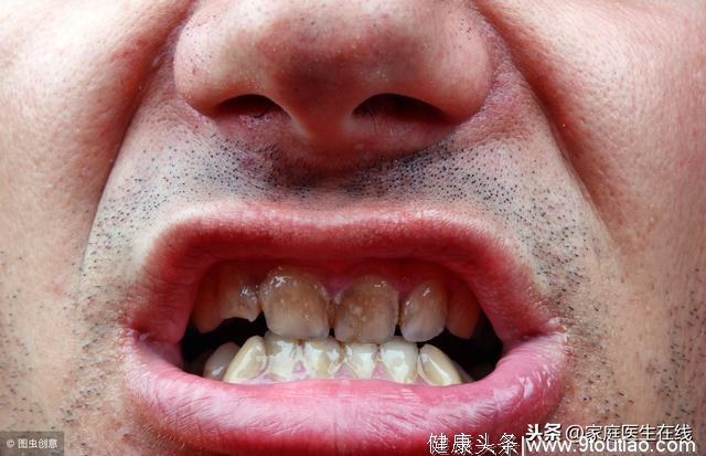 牙周炎有3大症状，发现了不治疗，老了牙齿掉光光！
