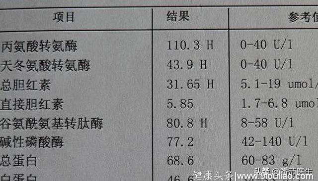 肝炎患者出现感冒症状 查一查肝功能 尿色浓茶色！