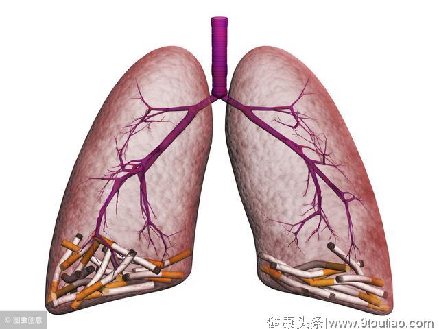 肺部有阴影究竟是怎么回事呢？一般来说肺部阴影的主要疾病有三类