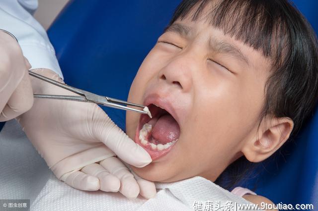 儿童牙齿诊疗过程中是如何把控风险因素的