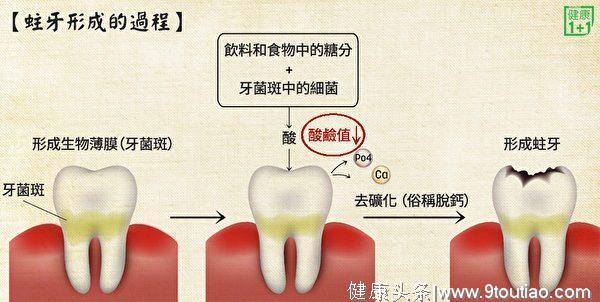 中医怎么对付蛀牙？这几个方子屡试不爽！