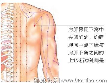 肩膀痛=“肩周炎”？每天用按2个穴位，7天肩周炎不来扰