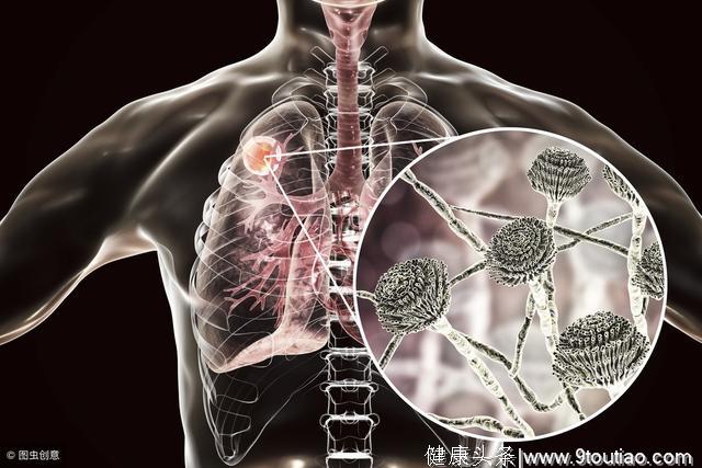 肺癌“祸根”，除却抽烟，3大习惯不改，会让你的肺越来越“黑”