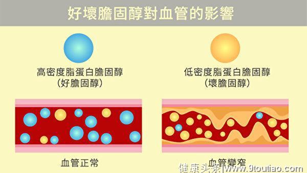 降坏胆固醇 增好胆固醇 你该吃这些食物