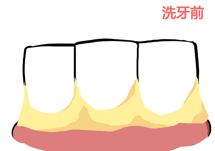 牙齿美白很重要，4大误区要知道，有些还会对牙齿有害!