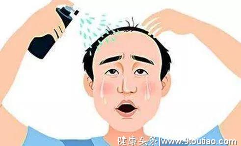 中国竟有1.4亿患病人群！脱发也是病，怎么治看这里