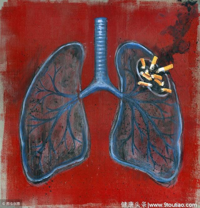 肺癌高发，但肺部阴影并不能与肺癌划等号