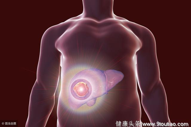 肝癌患者一半在中国，医生呼吁：3种食物要少碰，肝经受不起！