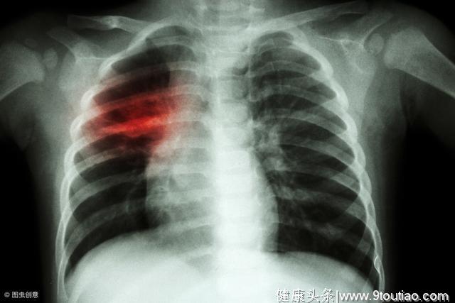 肺癌的致病因素有哪几个
