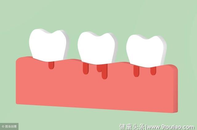 除了“3多1少”，糖尿病还有个小信号：身体这处疼要小心