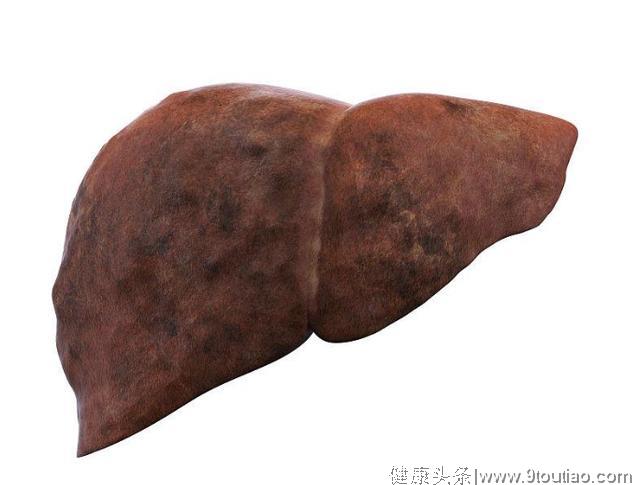 乙肝也会"吃"成肝癌，医生警示：3大致癌物，一定要尽早远离！
