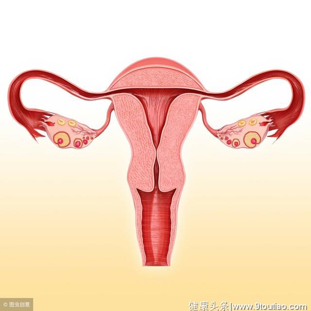 什么是子宫肌瘤？子宫肌瘤专挑这3类女性下手