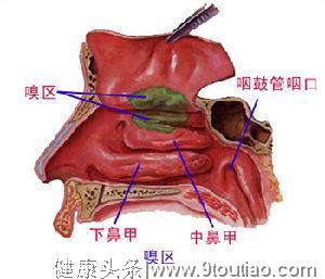 什么是萎缩性鼻炎？萎缩性鼻炎能治好吗？记住日常怎样预防。