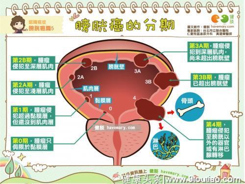 院士公布人体癌症地图：你身上，这12个器官最易患癌