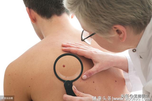 皮肤癌有望通过简单仪器早期发现