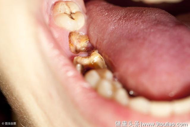牙齿好的人，一般不会有这4种症状，若你也是，证明牙齿还不错！