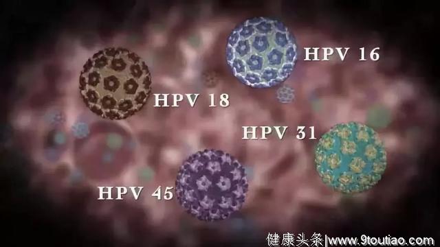 6岁男孩感染HPV 男性也要打宫颈癌疫苗？医生权威说法来了