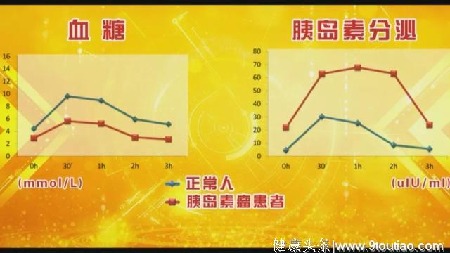 胰腺癌又称“癌王”！但专家提醒：早发现，16个病灶转移都能治