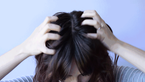 为什么头发油的人容易脱发？