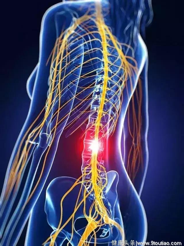 腰痛自疗方法：腰椎间盘突出、腰肌劳损，练这些动作，不花一分钱