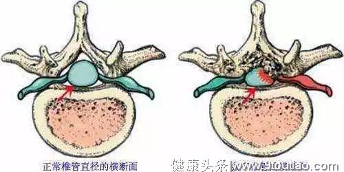 人到中年不由己，腿痛腿麻困扰你