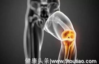 骨科医生：膝关节滑膜炎不能走路？2个中医食疗方法来帮你！