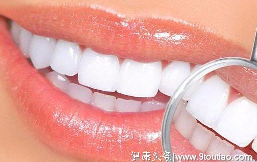 最新仿生类齿贴面美牙技术——齿加颜
