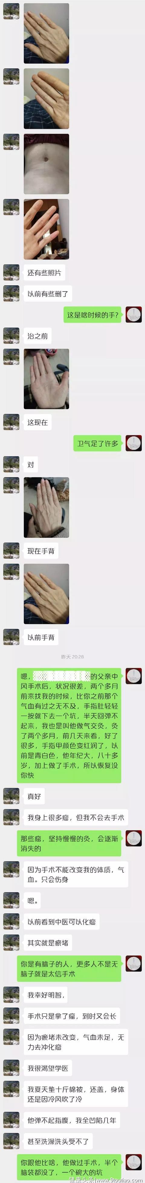 一个关于艾灸自治自救的故事