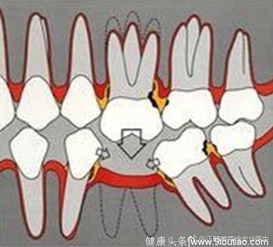 谈谈一般人想不到的口腔学冷门小知识