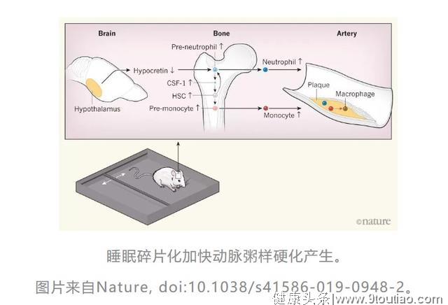 医生告诉你：睡眠被打断，原来害处这么多