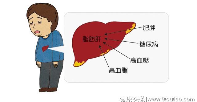 3种食物堪称脂肪肝“福星”！早晚吃一点，越吃肝脏越“轻盈”