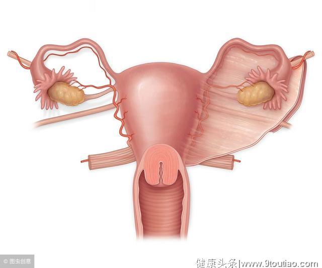 这3个不起眼症状都是子宫腺肌症“生事”