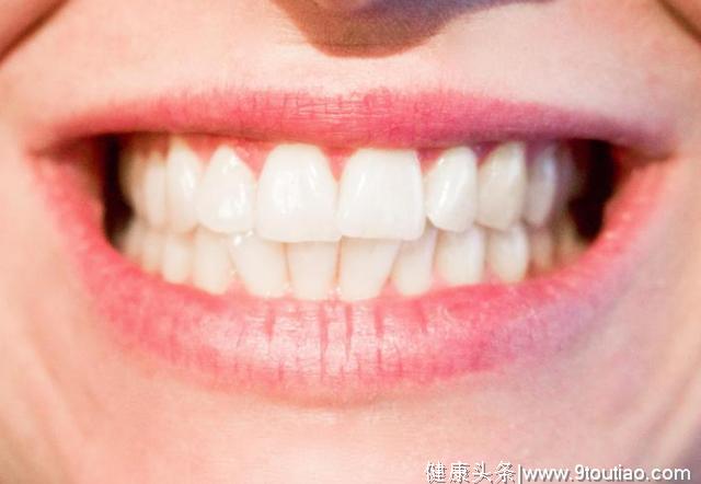 你的门牙上有白斑吗？常见牙齿变色的原因浅谈