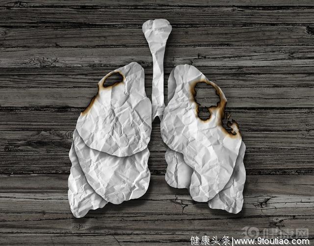 癌症知识：肺癌想要转移到别处，有两条“路”可走！