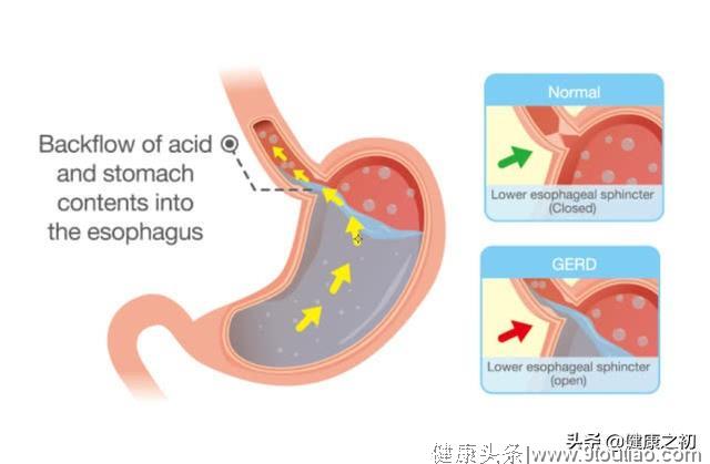 胸痛，不是冠心病竟是胃病！出现这6个症状，病根十有八九也在胃