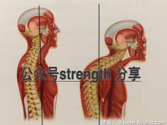 下背疼与腰疼的根源——垂直链之殇