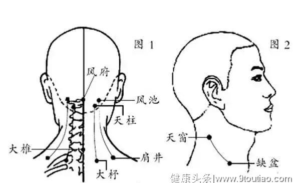 富贵包 我们的颈椎杀手之一 怎么治疗更好