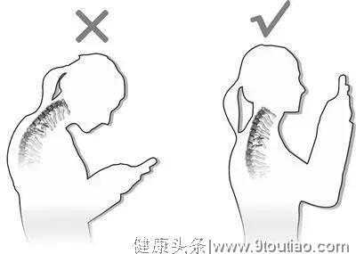 富贵包 我们的颈椎杀手之一 怎么治疗更好