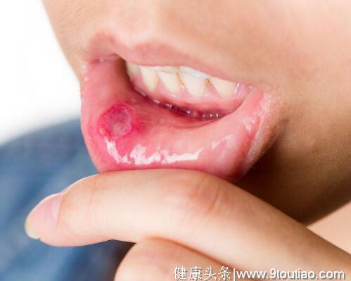 口腔持续出现4个异常，需留意：口腔癌可能离你不远了，别忽视