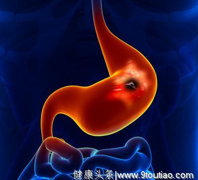 胃癌不是“哑巴”，身体可能会有三个表现，可能是胃部出现了病变