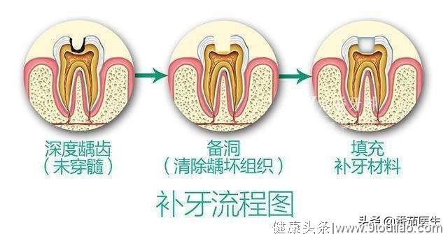 龋齿久不治疗 可引发肺炎 预防龋齿牢记3查！