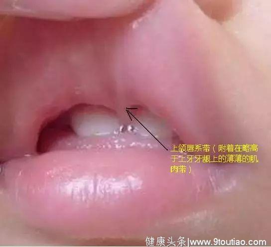 刷对了牙，才能让孩子没蛀牙！看看该如何做#葉子口腔科普#