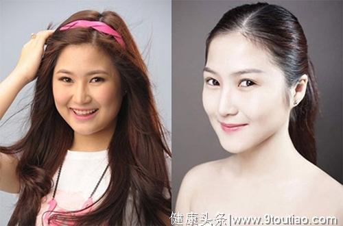 40岁杭州陈女士简单一方法，轻松减肥28斤，安全有效，不反弹