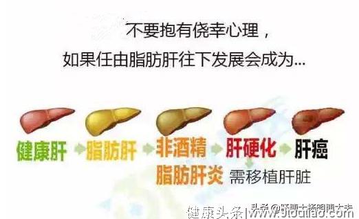 全国爱肝日：重视脂肪肝的防与治